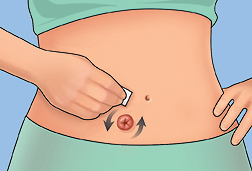 How to Apply Skin Prep in Ostomy Care